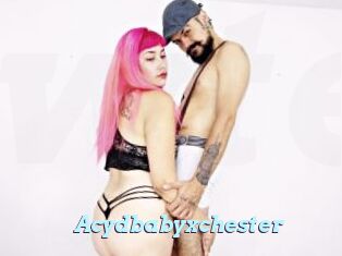 Acydbabyxchester